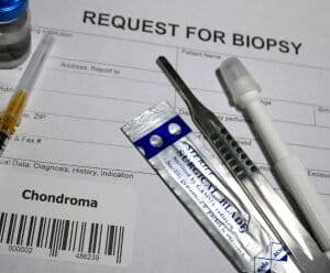 Biopsy