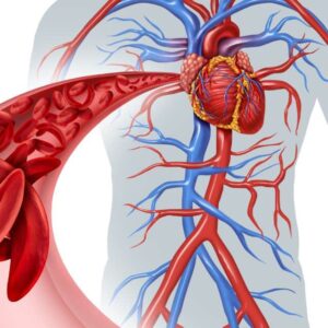 CT Coronary Angiography