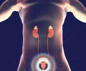 Contrast Mri Bladder