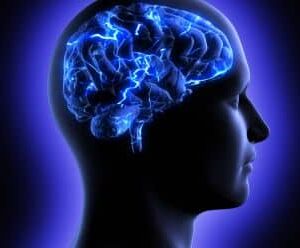 Contrast MR Angio Head