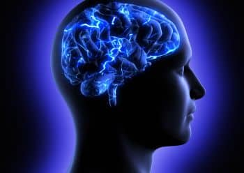 Contrast MR Angio Head