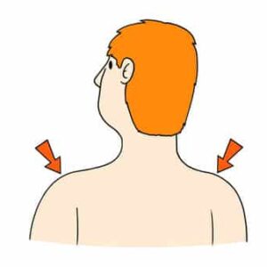 Contrast CT Shoulder